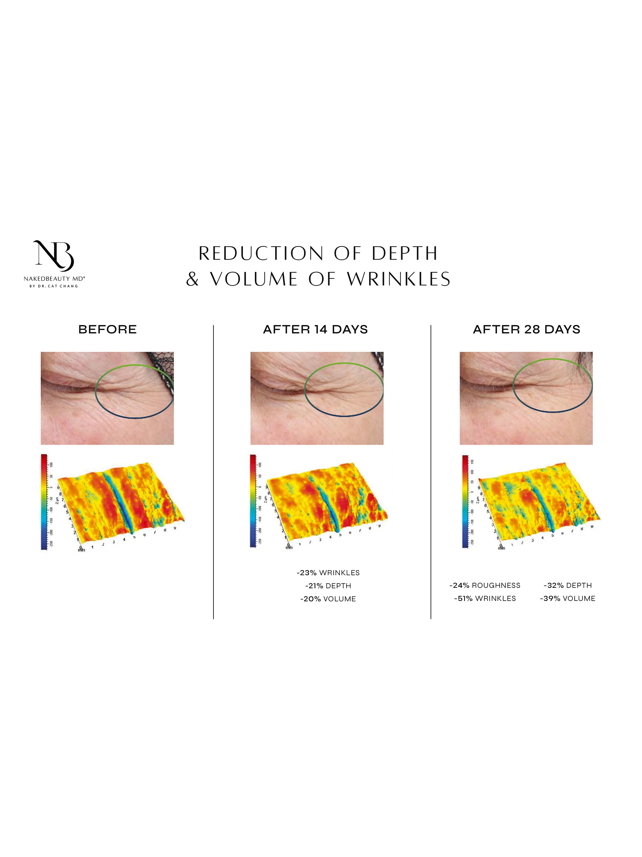 Biopeptide Growth Factor Eye Therapy - Image 8