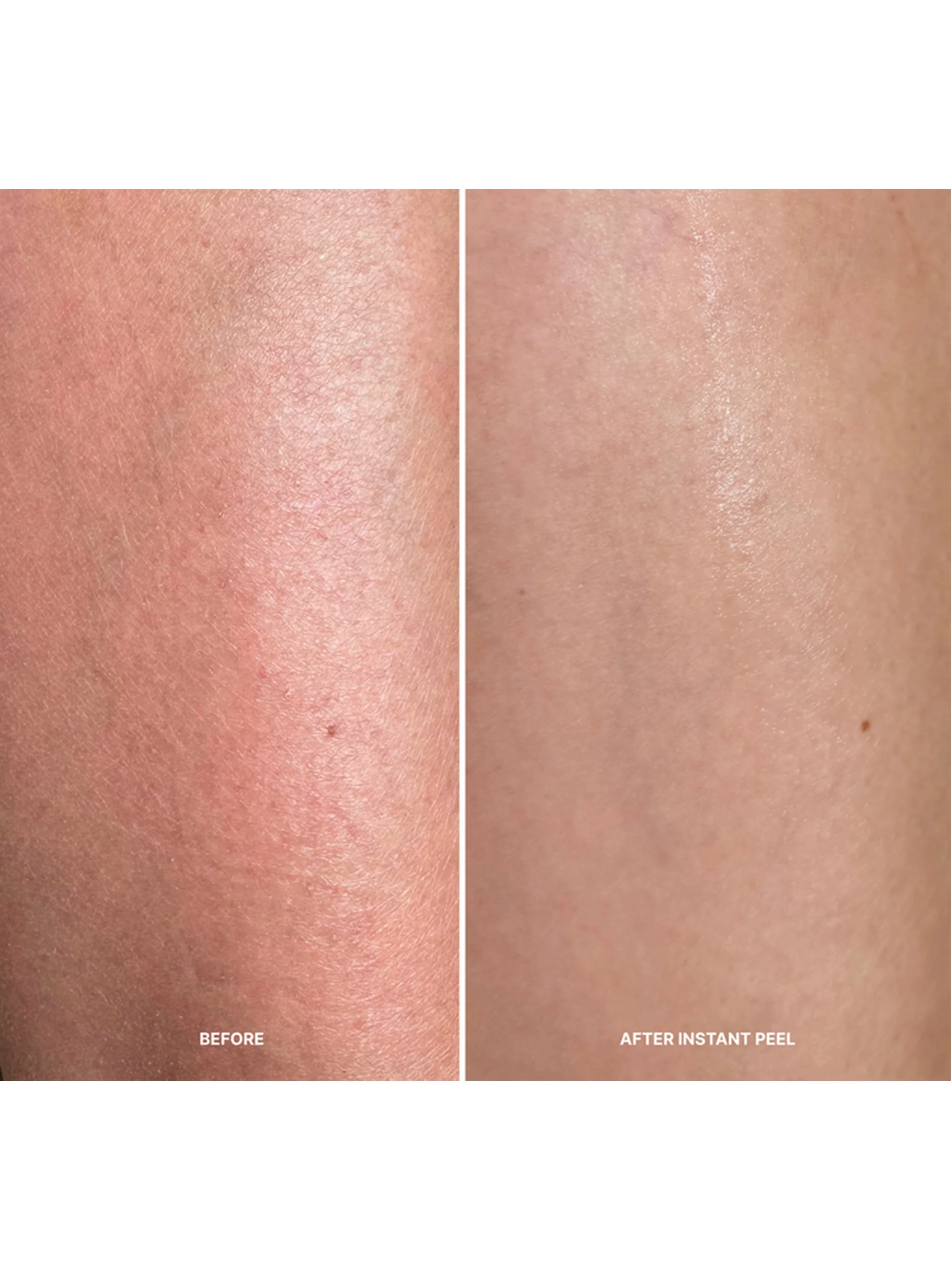 Instant Peel - Image 5